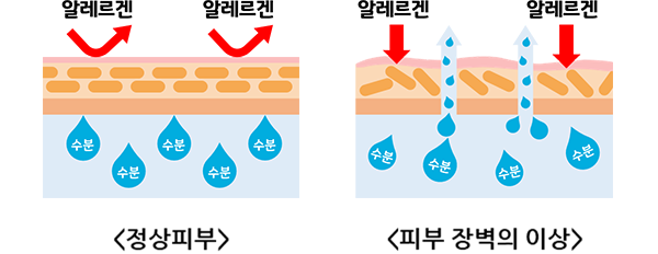 정상피부, 피부 장벽의 이상